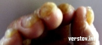 У магнитогорца оказались самые толстые ногти в мире. Но в рекордсмены он не попал
