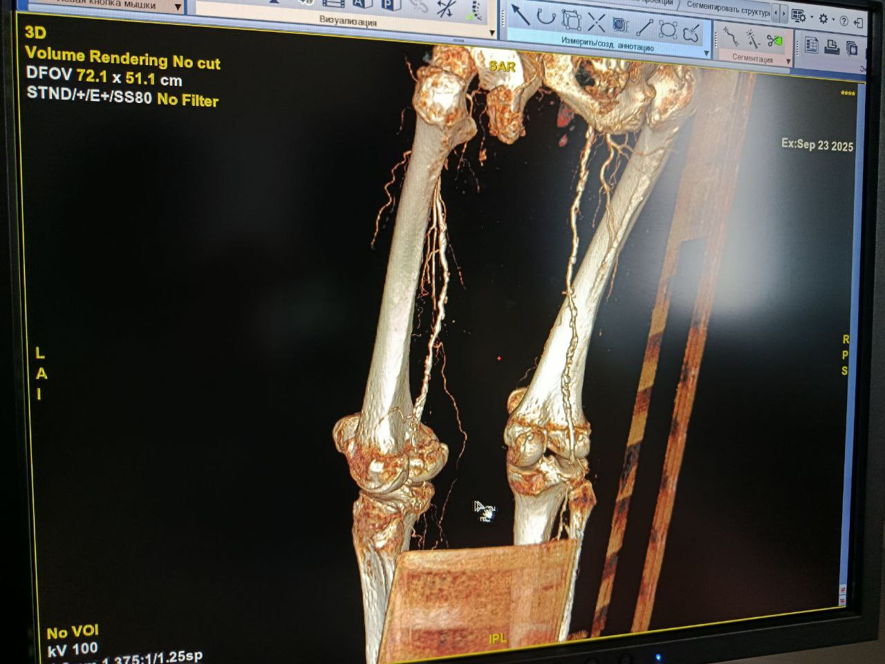 рентгенснимок пациенки.jpg