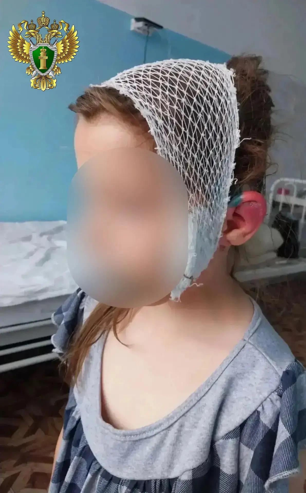 укус 1.jpg укус 1.jpg