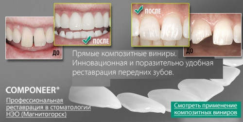 Профессиональная стоматология «НЭО» дарит акции каждый день!